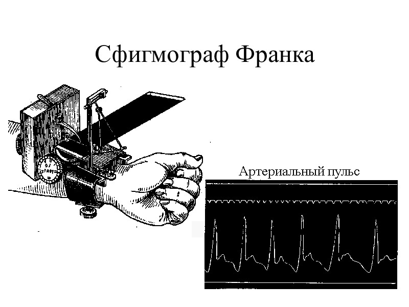 Сфигмограф Франка      Сфигмограмма артериального пульса  Артериальный пульс